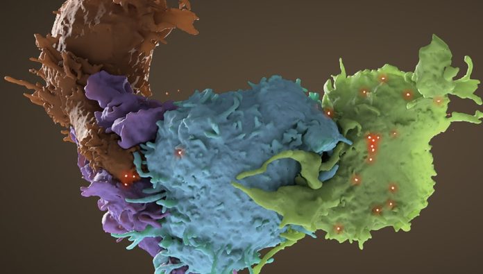 Posible cura del VIH