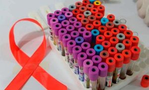 Estudio en personas con VIH