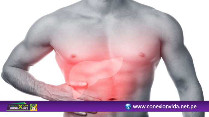 PLANTILLA ANUNCIOS CARABAYLLO