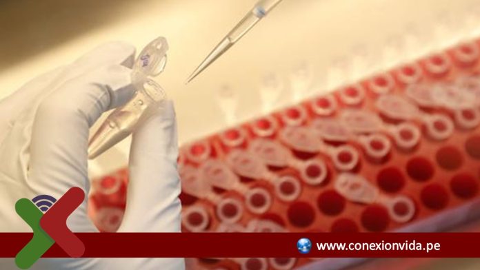 Nueva vacuna podría contener el VIH sin el tratamiento antirretroviral