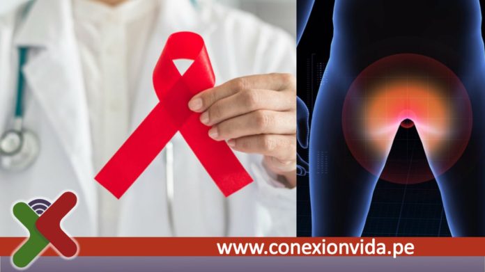 VIH tratamiento oportuno de las lesiones anales reduciría el riesgo de cáncer anal en un 57% en PVS