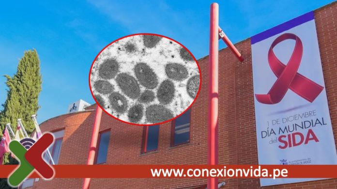 ONUSIDA preocupada por el lenguaje sobre la viruela del mono que estigmatiza a las personas LGTBI y africanas