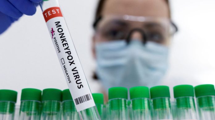 Viruela del Mono confirman el primer caso en Brasil