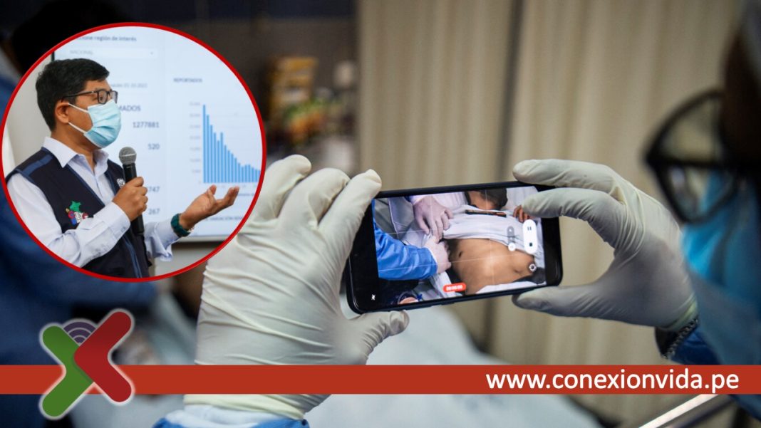 Viruela del mono y VIH / Foto: Ernesto Benavides - RPP